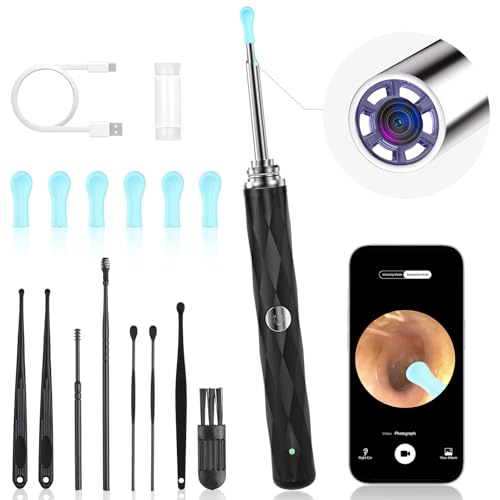 High-Definition Ear Wax Removal, Wireless Ear Cleaner, Safe and - Product Imagery