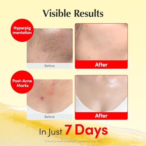 EQQUALBERRY Vitamin Illuminating Cream | Vitamin C & 5% - Product Imagery