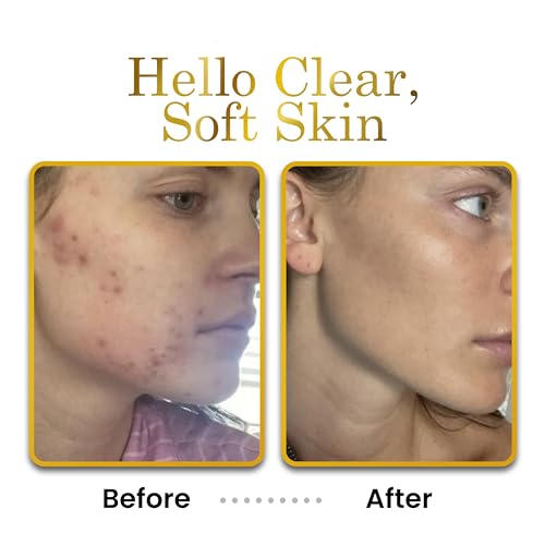 Luxe Beauty Non Greasy & Hyaluronic Acid Moisturizer for Face, - Product Imagery