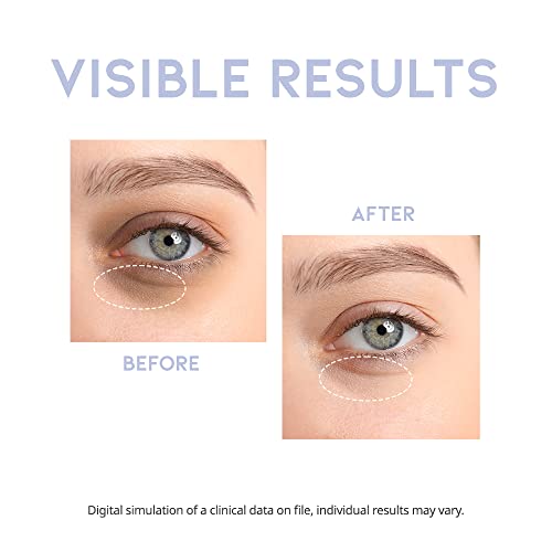 #OOTD Intensive Eye Serum with Hyaluronic Acid,1.01 fl oz | - Product Imagery