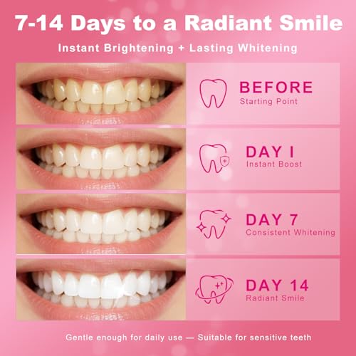 Teeth Whitening Kit with LED Light Tray for Sensitive Teeth, 5 - Product Imagery