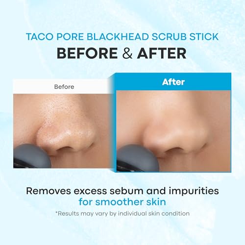 TONYMOLY Tako Pore Clay Scrub Stick, Korean Blackhead Exfoliator, - Product Imagery