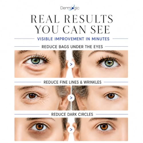Under Eye Puffiness & Dark Circles Rapid Treatment- Instantly - Product Imagery