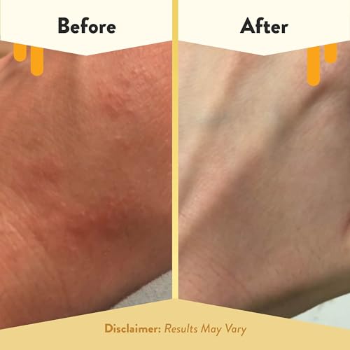 ECZEMA HONEY Oatmeal Body Lotion, Natural Dry Skin Repair (16 Oz) - Product Imagery