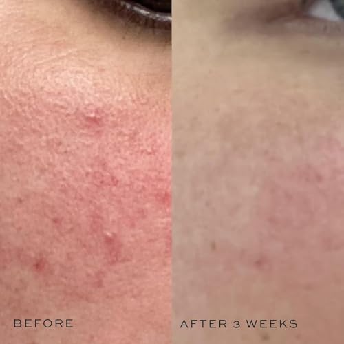 DIME Beauty Super Skin Toner - Witch Hazel Face Toner, 4 oz - Product Imagery