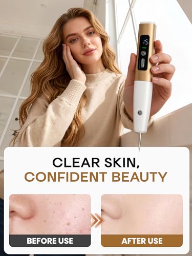 USB Rechargeable Skin Tag Remover Pen - Product Imagery