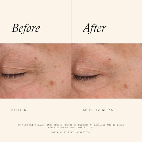 SkinMedica Retinol Serum 1.0 Complex - Serum for Face, - Product Imagery