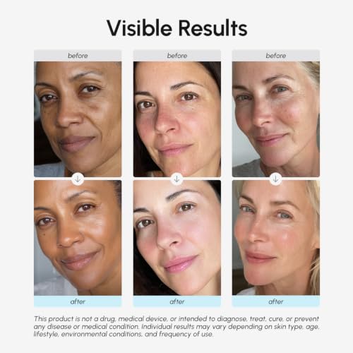 MAREE Face Moisturizer Retinol Cream for Face – Daily Wrinkle - Product Imagery