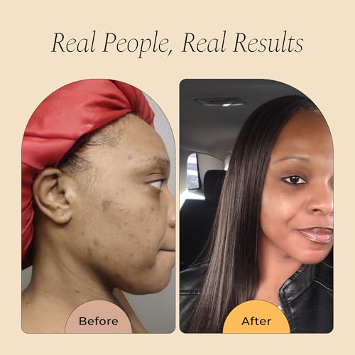 Glo Melanin Rose Glo Oil – Natural Brightening & Soothing Facial - Product Imagery