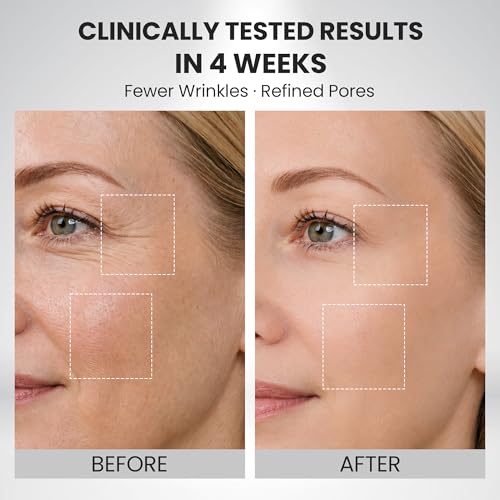 Wireless Red Light Therapy Face Mask, 4 Modes for Wrinkles, Fine - Product Imagery