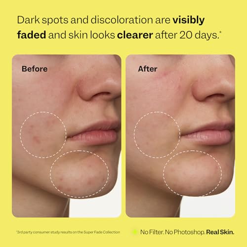 Peach Slices - Super Fade Discoloration Serum for Face (1.01 o... - Product Imagery