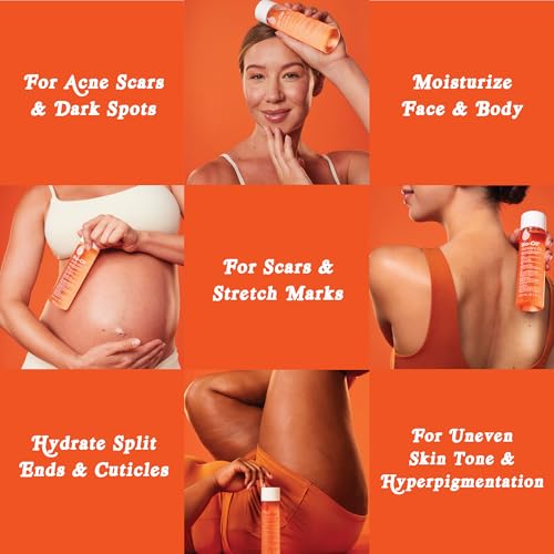 Bio-Oil Skincare Body Oil Serum for Scars and Stretch Marks, - Product Imagery