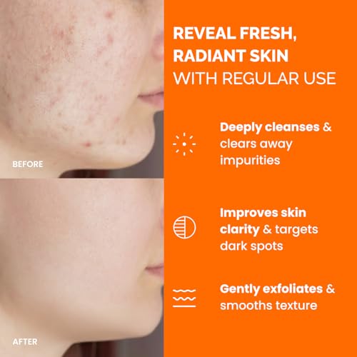 PLANTIFIQUE Kojic Acid & Turmeric Cleansing Pads for Dark Spots, - Product Imagery