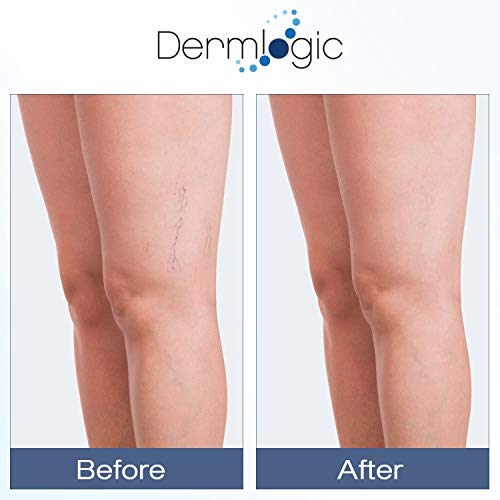 Vitamin K Cream- Moisturizing Bruise Healing Formula. Dark Spot - Product Imagery
