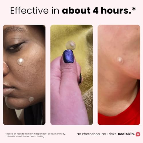 ROSELYNBOUTIQUE Pimple Patches for Face - Hydrocolloid Acne - Product Imagery