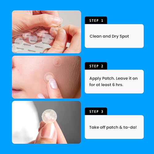 AVARELLE Original Hydrocolloid Acne Pimple Patches for Face 40 - Product Imagery