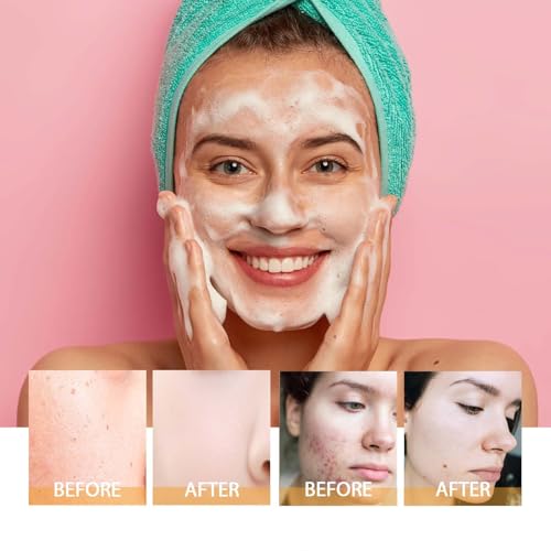2 Pcs Turmeric Facial Cleanser, Glow Wash Turmeric Face Wash - Product Imagery
