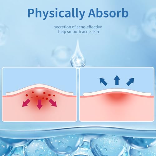 Pimple Patches for Face, 4 Size 300 Counts Hydrocolloid Acne - Product Imagery