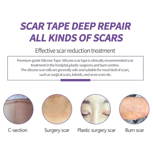 Medical Grade Silicone Scar Sheets, (1.6" x 60" Scar Roll-1.5M) - Product Imagery