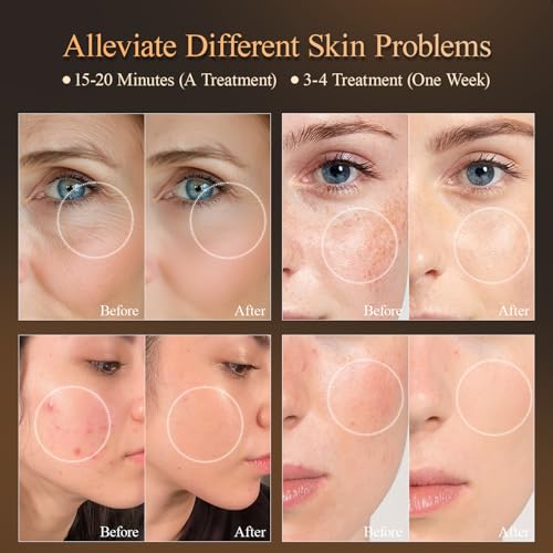 MEGELIN 7 Colors Led Light Therapy Facial Mask, Face Light - Product Imagery