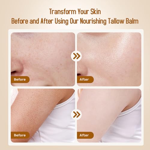 Hicream Beef Tallow for Skin, Beef Tallow and Honey Balm, 100% - Product Imagery