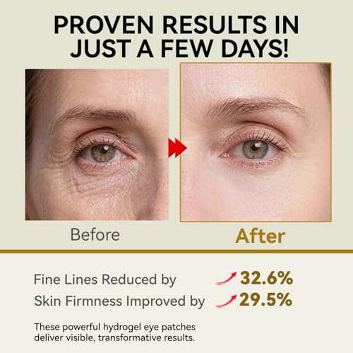 PDRN Under Eye Patches, 25 Pairs Retinol & Caffeine Eye Mask, - Product Imagery