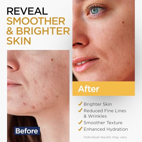 Vitamin C Serum for Face with Stem Cells & Hyaluronic Acid 1 Oz - Product Imagery