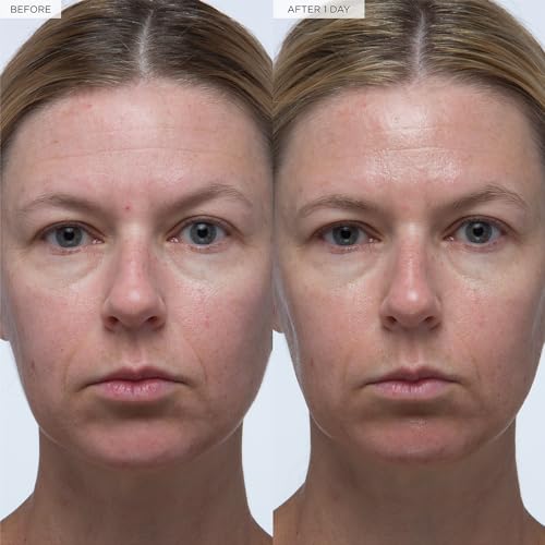 Glow Recipe Plum Plump Hyaluronic Acid Serum, Hydrating + - Product Imagery