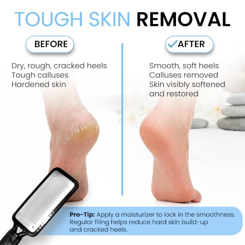 Colossal Foot rasp Foot File and Callus Remover. Best Foot Care - Product Imagery