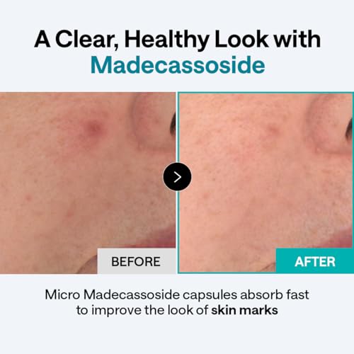 MEDIHEAL Madecassoside Derma Cream for Blemish Repair & Calming - Product Imagery