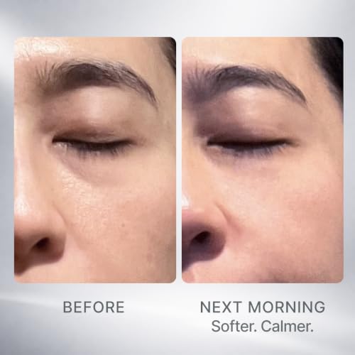 Overnight Face Mask, Hydrating Sleeping Mask for Dry Skin, Night - Product Imagery