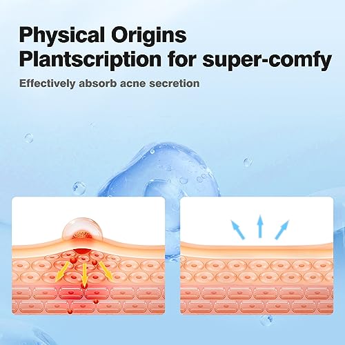 Pimple Patches for Face, Hydrocolloid Acne Patches, Cute Star - Product Imagery