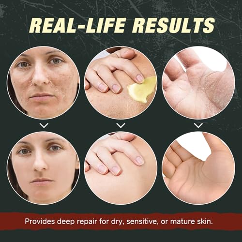Beef Tallow for Skin & Face Cream with Castor Oil and - Product Imagery