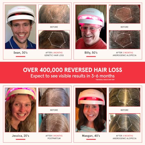 iRestore Essential Laser Hair Growth System + Rechargeable - Product Imagery