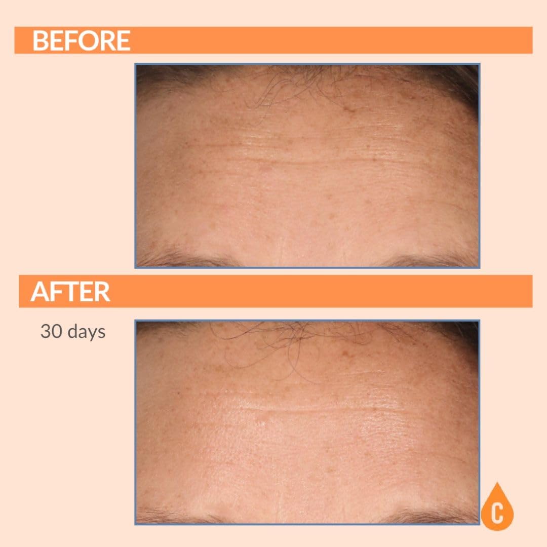 Serious Skincare Vitamin C Serum for Face Anti Aging for - Serious Skincare Official Imagery - 6