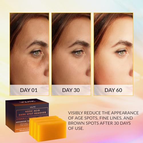 VALITIC Kojic Acid Dark Spot Remover Soap Bars, Turmeric Bar - Product Imagery