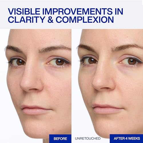 IOPE Expert Vitamin C 25% Antioxidant Serum - 25% Pure Vitamin C - Product Imagery