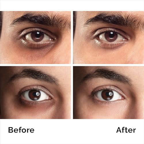 PURE RESEARCH Caffeine Eye Cream For Anti Aging, Dark Circles, - Product Imagery