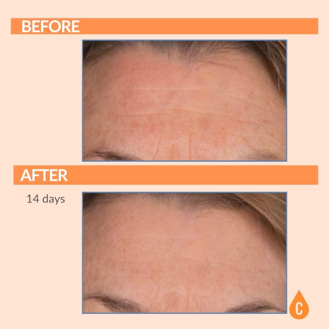 Serious Skincare Vitamin C Serum for Face Anti Aging for - Serious Skincare Official Imagery - 5