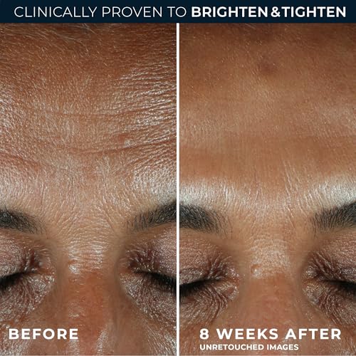 RoC Vitamin C Serum for Face Multi Correxion Revive + Glow, 10% - Product Imagery