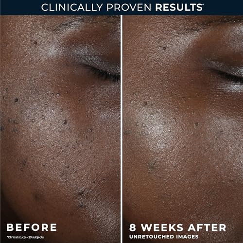 RoC Niacinamide Even Tone + Lift Anti Aging Night Cream, Face - Product Imagery