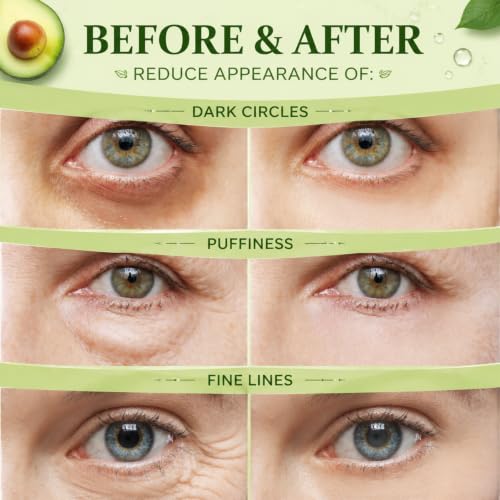 60PCS Avocado Under Eye Patches, Eye Masks for Dark Circles and - Product Imagery