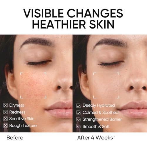 SKINTIFIC 5X Ceramide Barrier Repair Moisturizer for Sensitive - Product Imagery