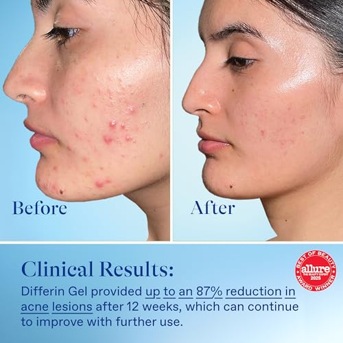 Differin Acne Retinoid Treatment Gel, 0.1% Adapalene, 15g Tube, - Product Imagery