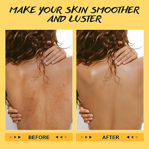 Turmeric Vitamin C Body Scrub Remove Dead Skin Exfoliating for - Product Imagery