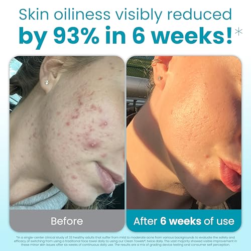 CLEAN SKIN CLUB Blemish Control Clean Towels® XL, Extra - Product Imagery