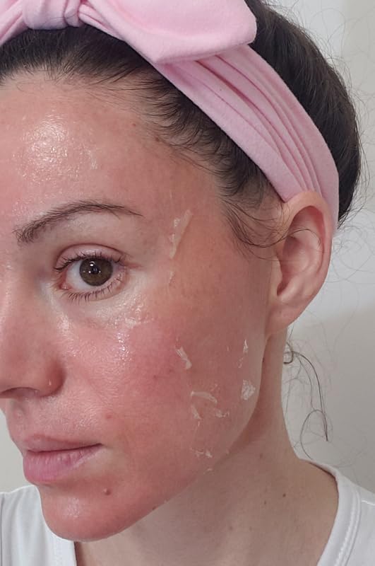 Jessner Chemical Peel Solution 35% – Professional Exfoliating - Product Imagery