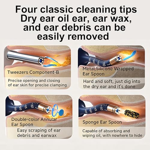 Ear Wax Removal Camera with Light, 1080P HD Visual Ear Cleaner, - Product Imagery