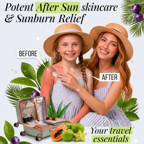 9% Panthenol Cream, After Sun Skincare & Redness Relief - Product Imagery