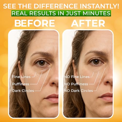 Puffy Eye Treatment Instant results – Naturally Eliminate - Product Imagery